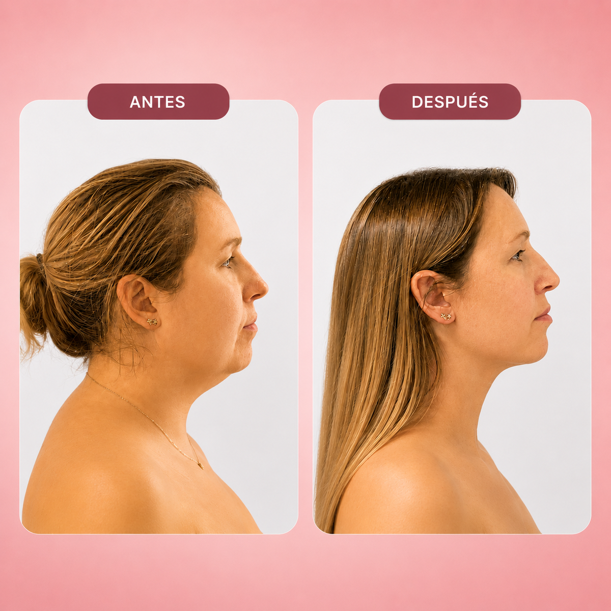 Lifting Band | Esculpe y Reafirma tu Rostro